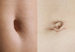 innie and outie belly button
